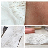 چسب بینی ضد جوش سر سیاه لانبنا