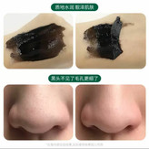 ماسک بینی ذغالی سالیسیلیک اسید زوسان ZooSon