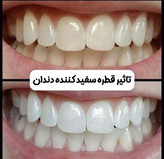 محلول سفید و درخشان کننده دندان لانبنا